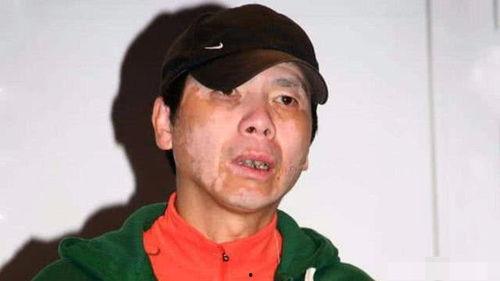 白斑病明星,勇敢面对挑战，照亮生活光彩